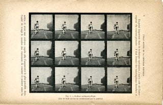REMARQUES TECHNIQUES SUR L'APPLICATION DES SCIENCES PHOTOGRAPHIQUES A LA CHIRURGIE NERVEUSE
